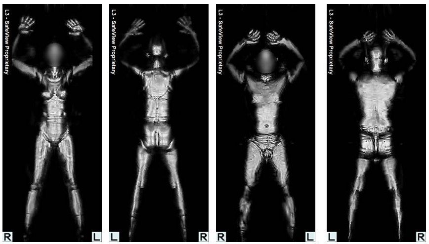 Do They Xray Checked Luggage: What Travelers Need to Know