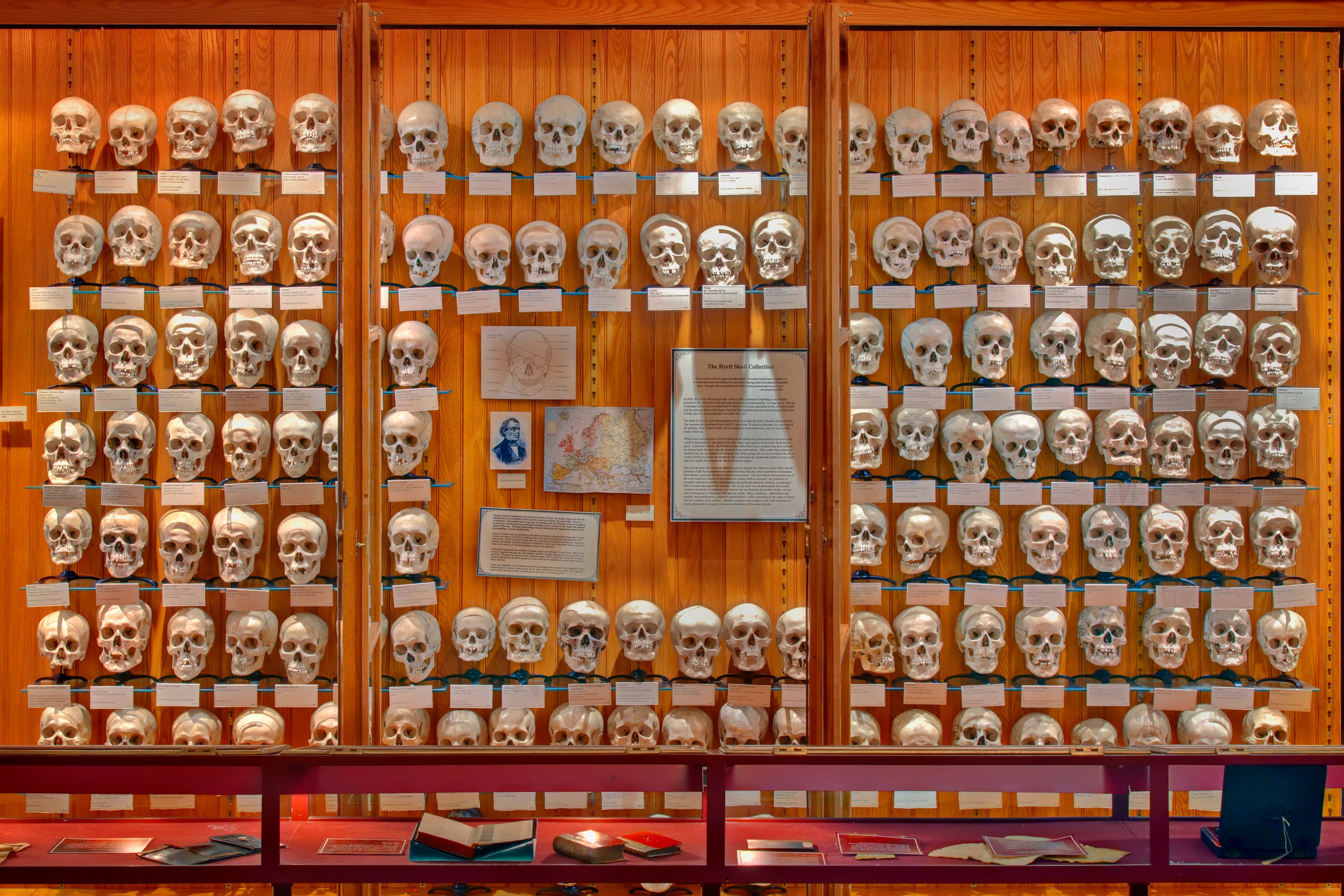 Image courtesy of George Widman for the Mütter Museum of The College of Physicians of Philadelphia.