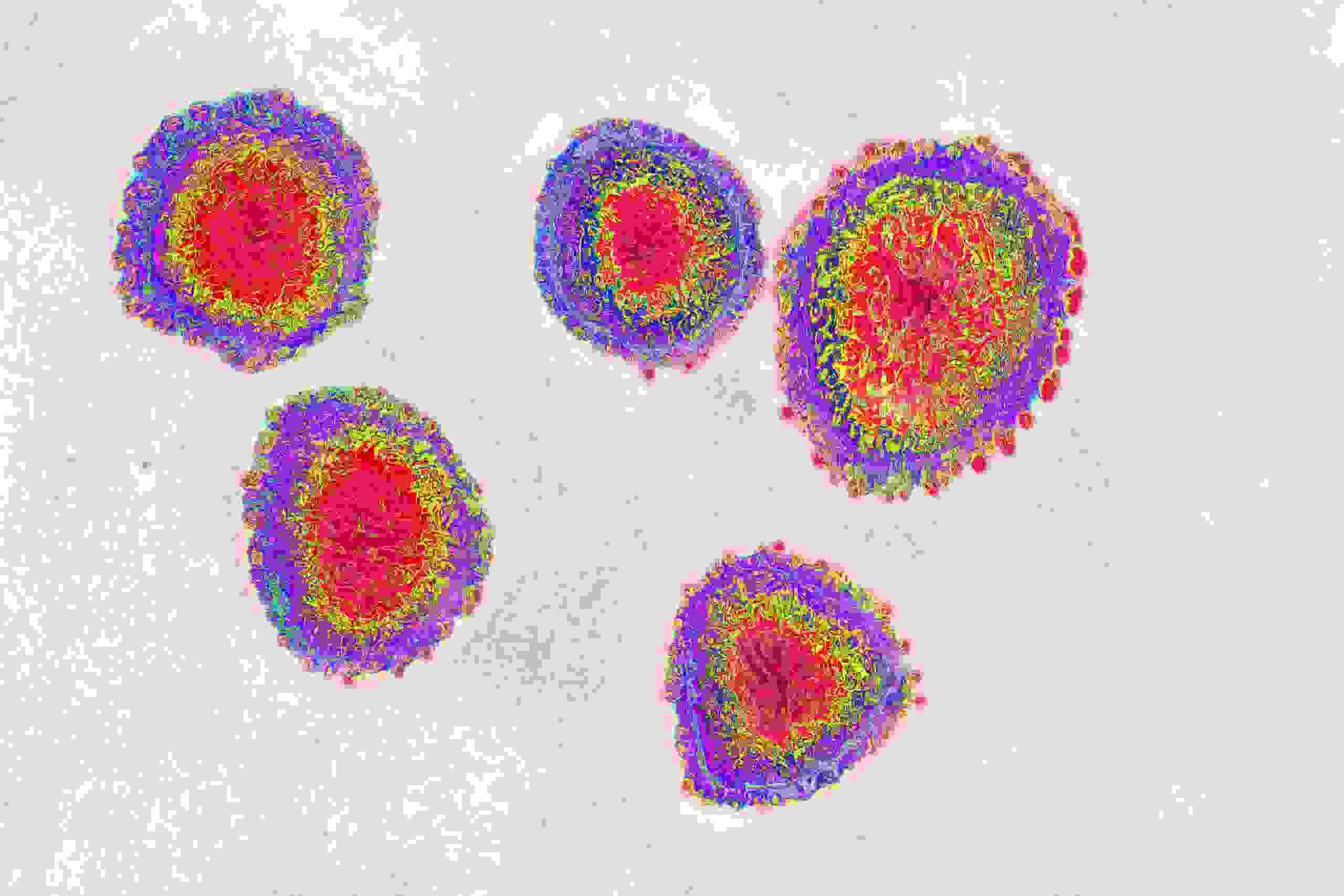 The human coronavirus causes respiratory infections (colds), and gastroenteritis. Image made from a transmission electron microscopy view. Approximate viral diameter: 80 to 160 nm. (Photo by: Cavallini James/BSIP/Universal Images Group via Getty Images)
