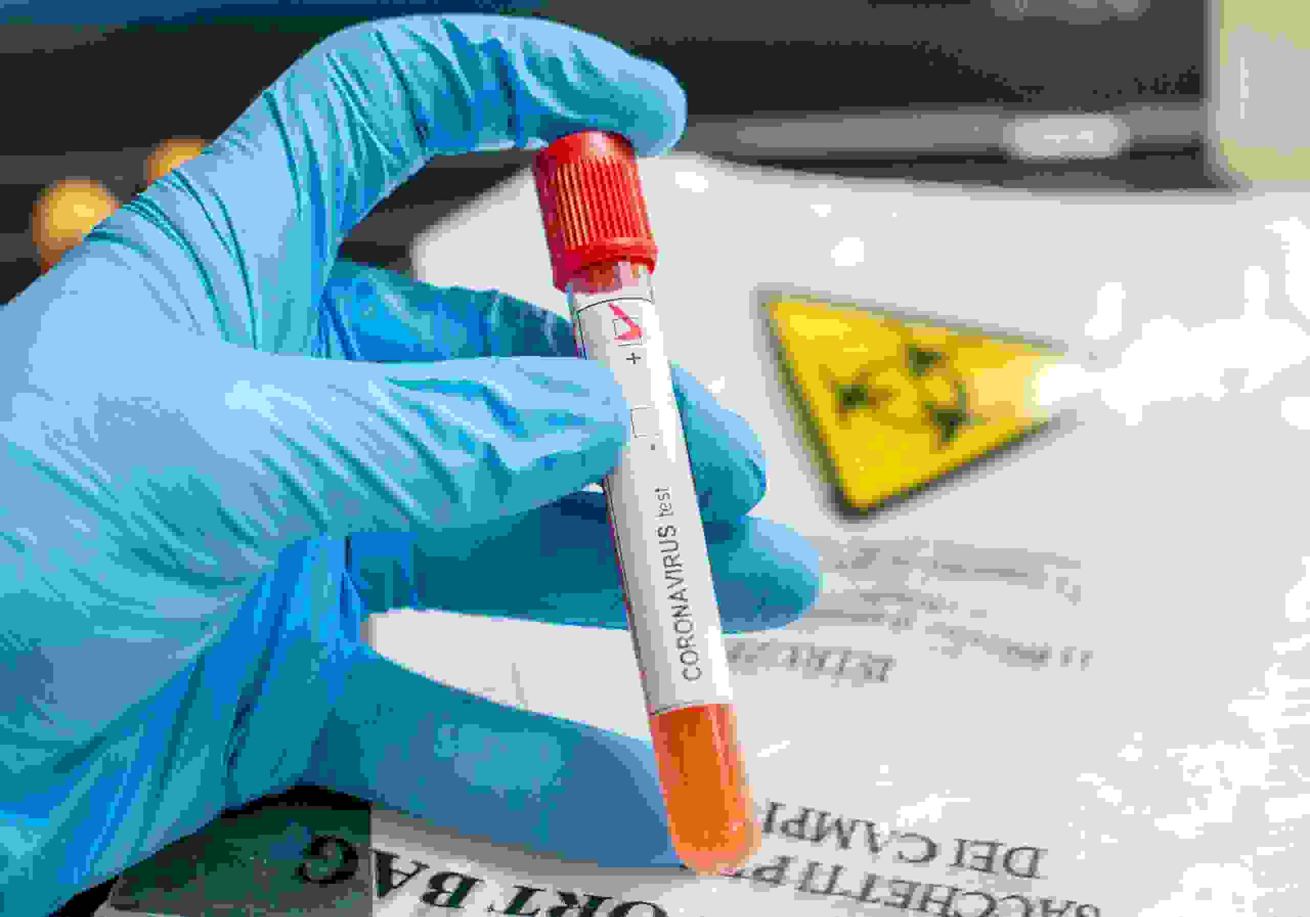 Coronavirus test