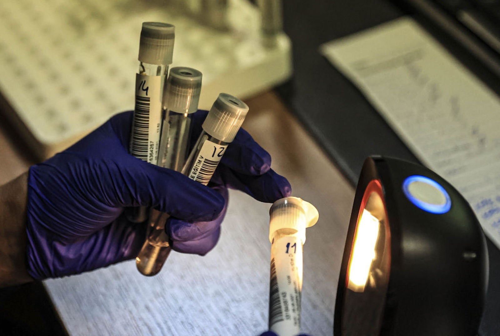 ANKARA, TURKEY - AUGUST 28: Samples of PCR tests are seen at Yildirim Beyazit University Yenimahalle Training and Research Hospital in Ankara, Turkey on August 28, 2021. Molecular microbiology laboratory works hard to finalize the PCR tests, which is the most critical stage in the diagnosis of Covid-19. (Photo by Metin Aktas/Anadolu Agency via Getty Images)