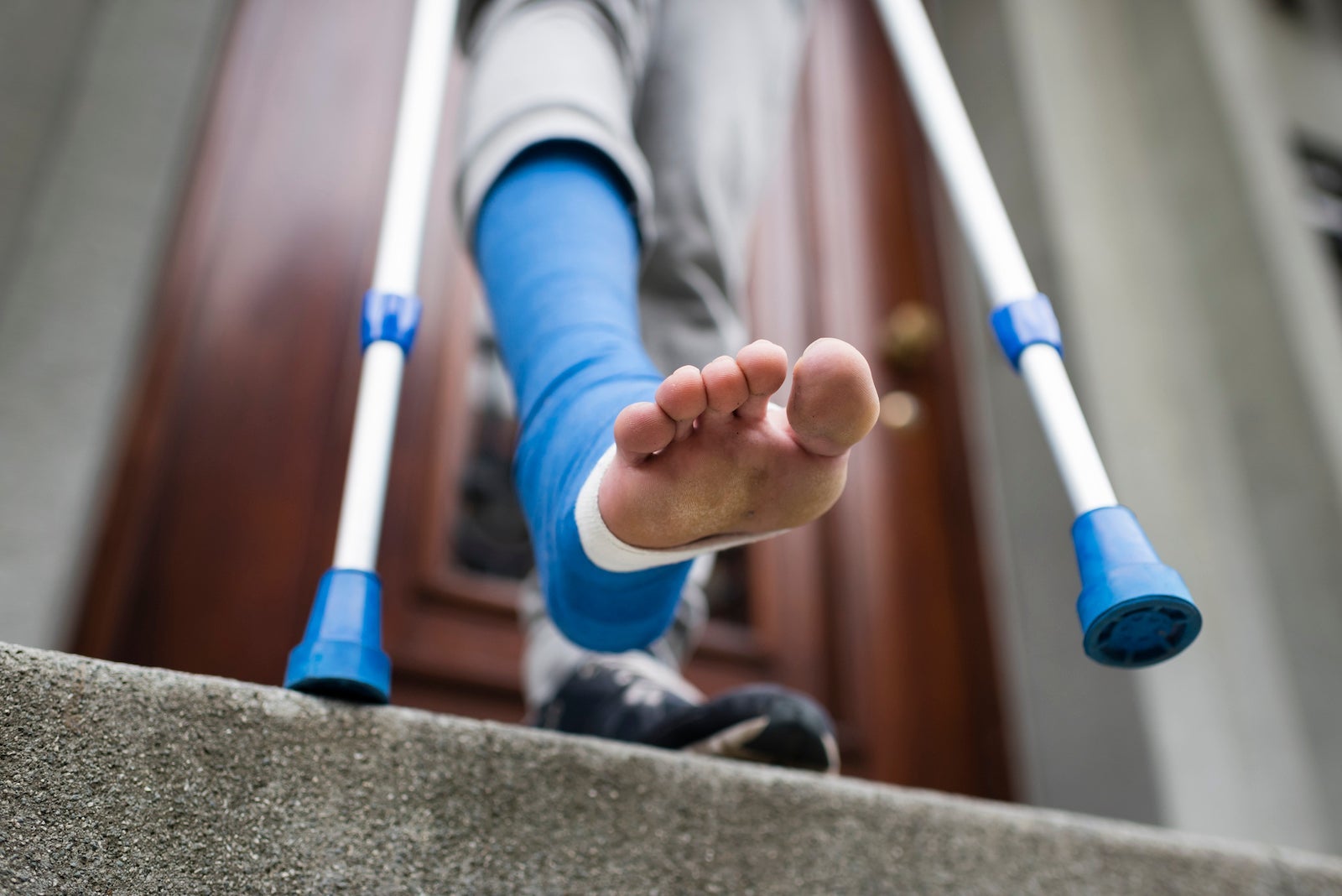 A photo of an injured foot